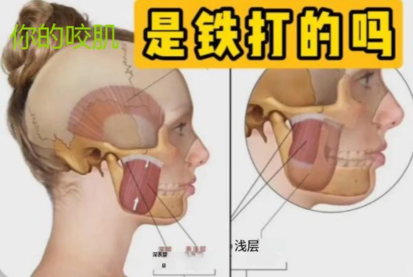 脸大是什么原因