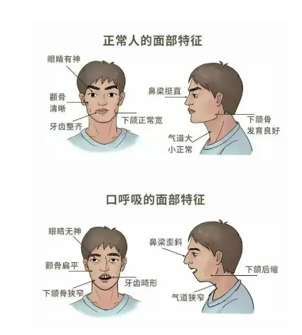 瘦脸最快最有效的方法