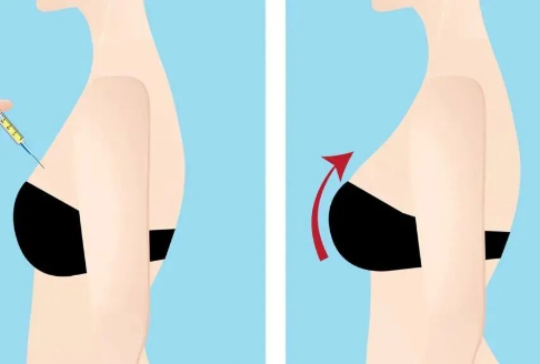 丰胸最好的方法