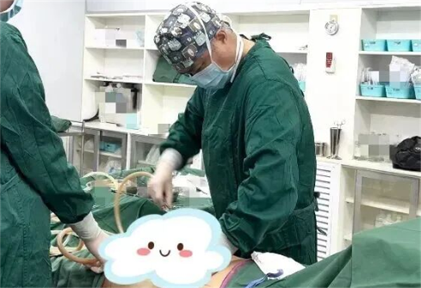 国内吸脂最好的医生