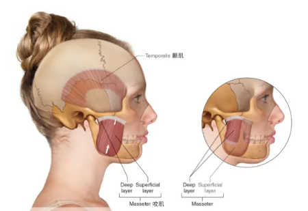 脸胖怎么样才能瘦脸