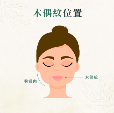 木偶纹是怎么形成的