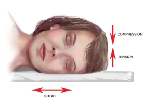 瘦脸的最好方法男生