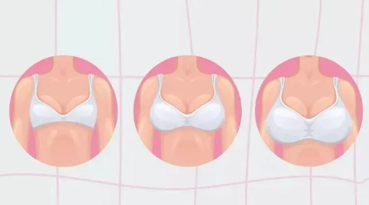 自体脂肪丰胸安全可靠吗