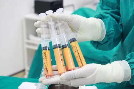 自体脂肪隆胸好不好