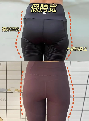 假胯宽是什么原因造成的