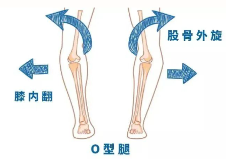 腿型不好看可以改善吗
