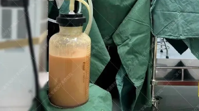 怎么吃才能不胖