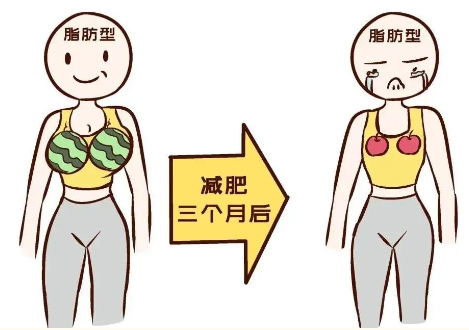 吸脂能减肥吗
