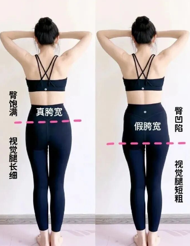 假胯宽怎么矫正