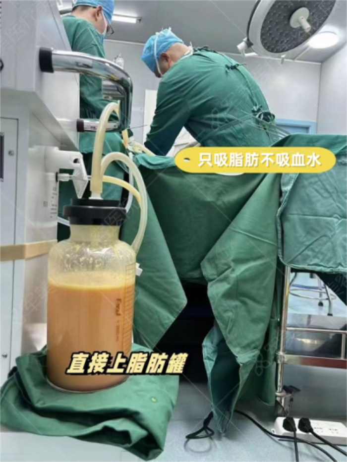 广州军美吸脂