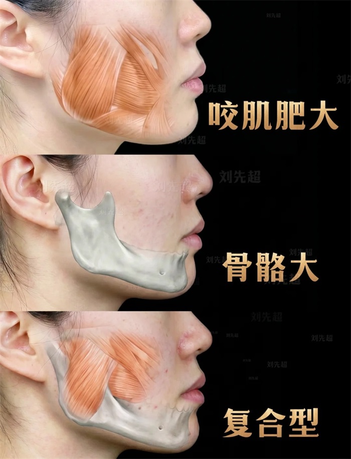 大饼脸怎么改善脸型