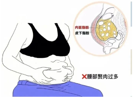 腰腹脂肪顽固怎么办