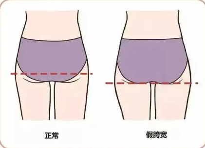 假胯宽示意图