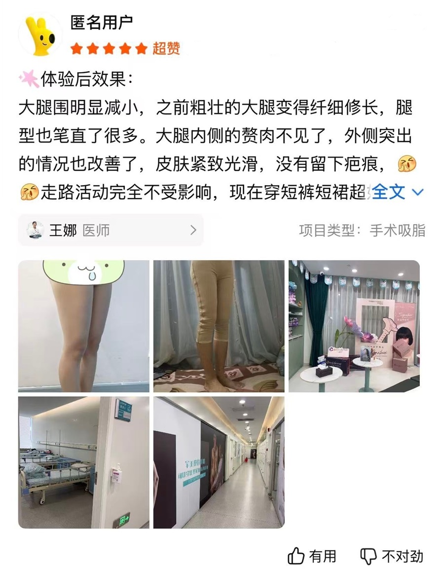 王娜口碑评价