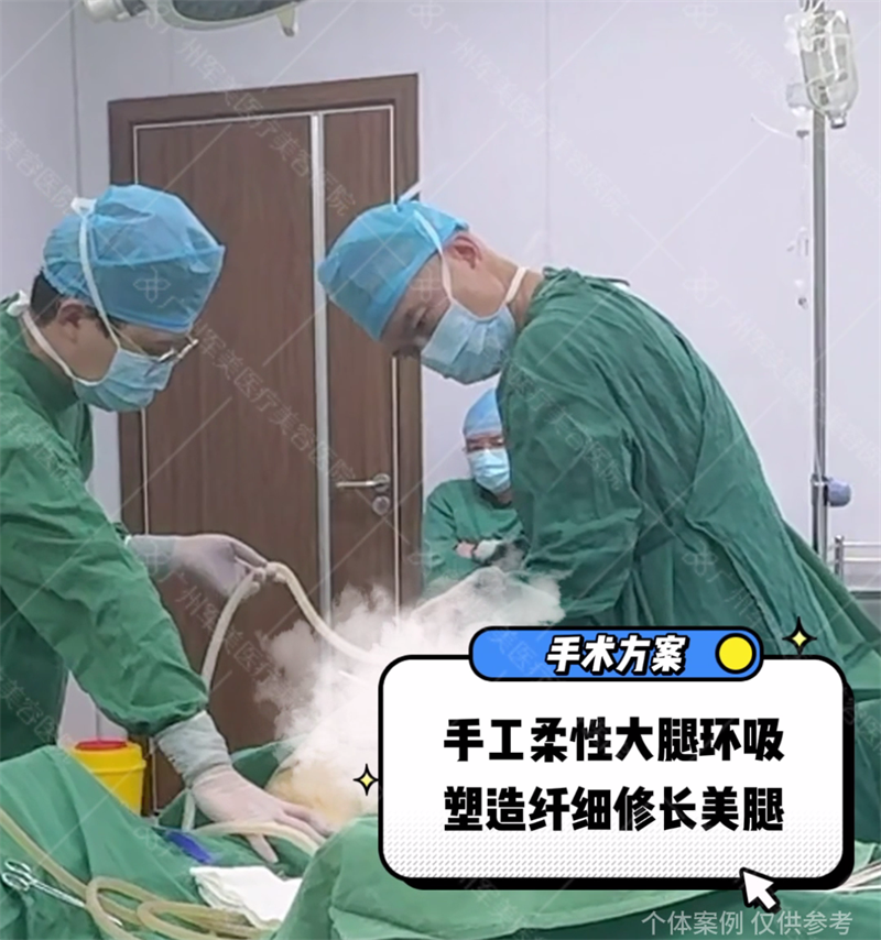 王世虎吸脂
