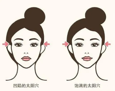脸垮下垂怎么改善