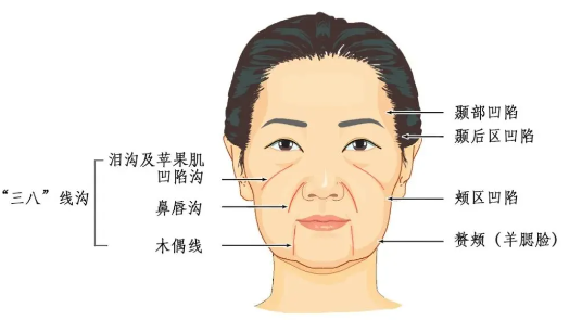 面部凹陷怎么救