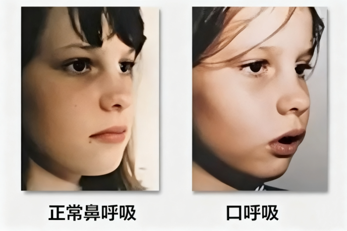 下颌线怎么收紧