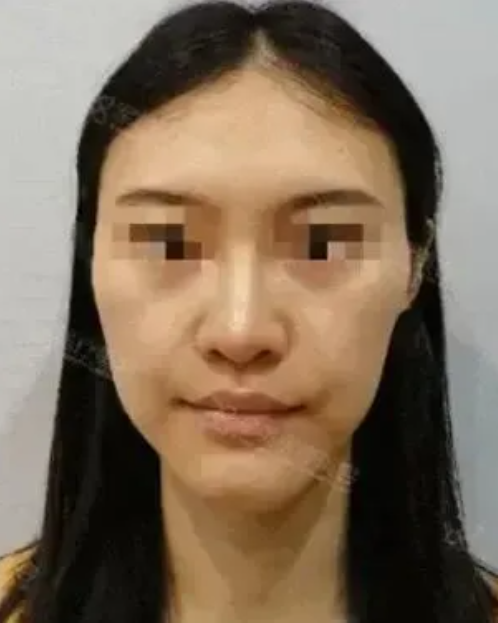瘦脸的最好方法