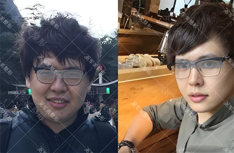 小V脸.jpg
