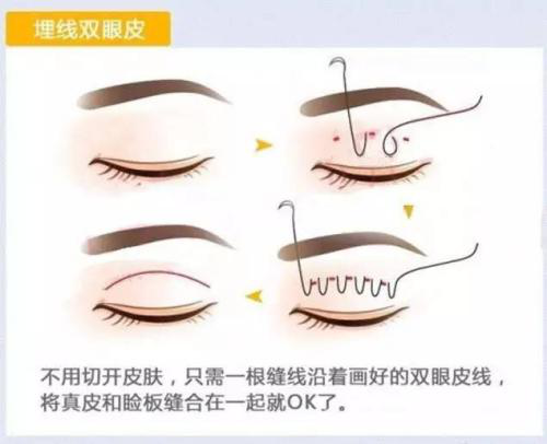 图片14.png
