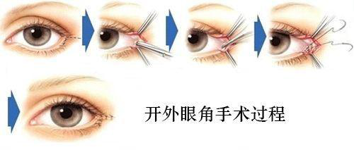 图片9.png