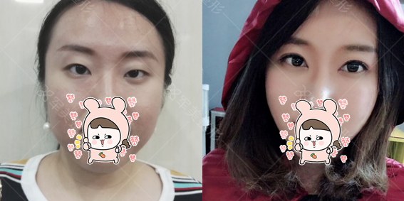 图片12.png
