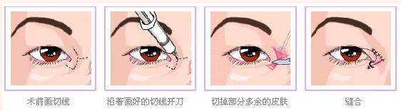 图片7.png