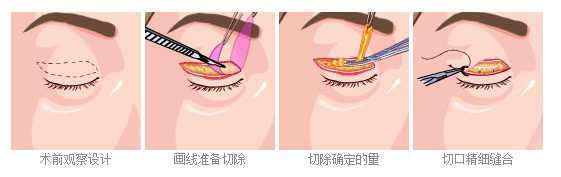 图片6.png