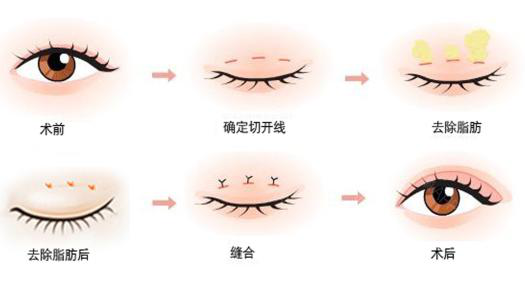 图片9.png