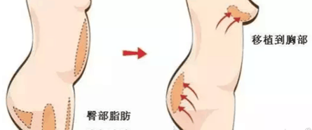 图片11.png