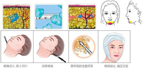 图片18.png