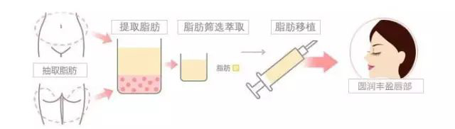 图片10.png
