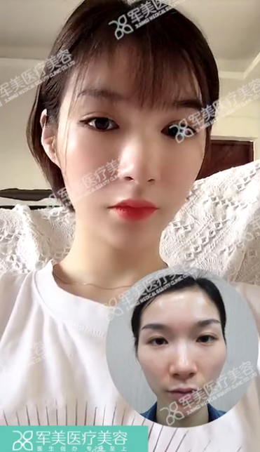 图片25.png